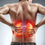 Viêm bể thận cấp