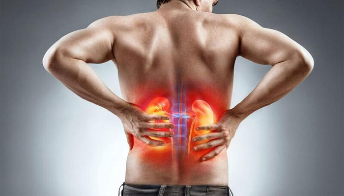 Viêm bể thận cấp